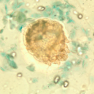 Sarcoptes scabiei akarı yakın çekim